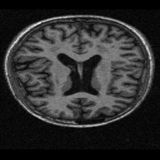 Brain CrossSection